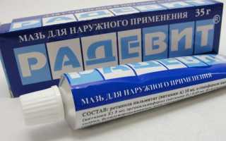 Как избавиться от боли при ожоге?