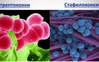 Чем отличаются и как лечатся стафилококк и стрептококк