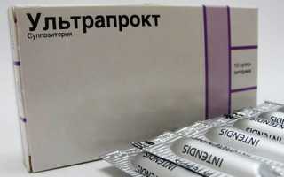 Противовоспалительные ректальные свечи для кишечника
