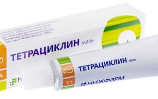 Использование тетрациклиновой мази при ожогах