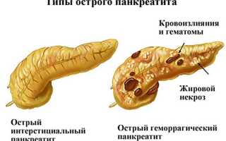 Почему болит спина и живот одновременно — причины