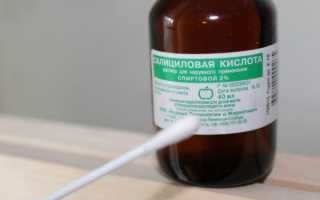 Подсушиваем прыщи на лице в домашних условиях