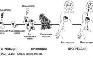 Что такое меланома кожи по МКБ-10