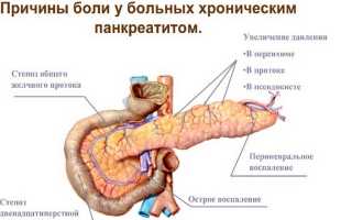 Причины боли в области поджелудочной железы у человека