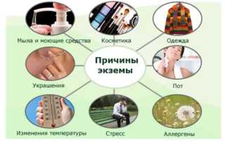 Действенные народные средства применяемые в лечении экземы