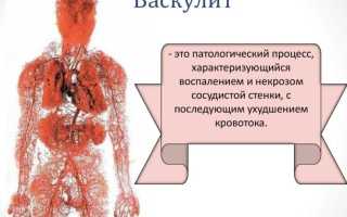 Опасные проявления и лечение геморрагического васкулита у детей (болезни Шенлейна-Геноха)