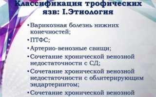 Виды трофических язв по МКБ-10