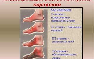 Что делать при ожоге ноги?