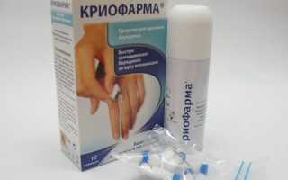 Как вывести папилломы с использованием Криофармы