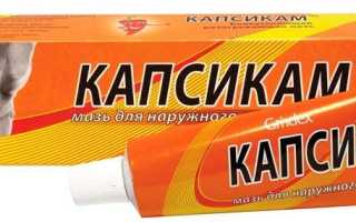 Ожог от применения мази «Капсикам»