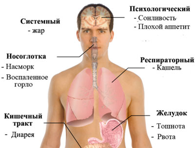 Симптомы свиного гриппа